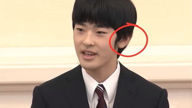 悠仁さま　もみあげ　非対称　成年会見　画像