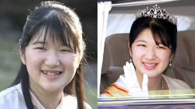 愛子さま　歯並びの変化　比較画像